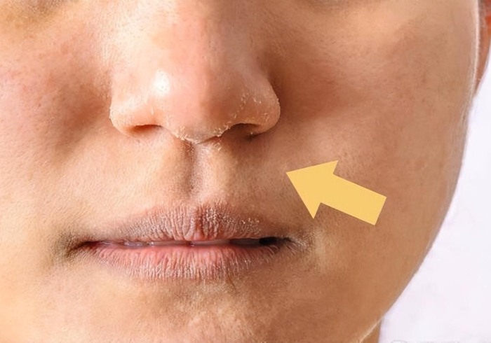 【新冠肺部变白/新冠肺部变白会好吗】 【新冠肺部变白/新冠肺部变白会好吗】