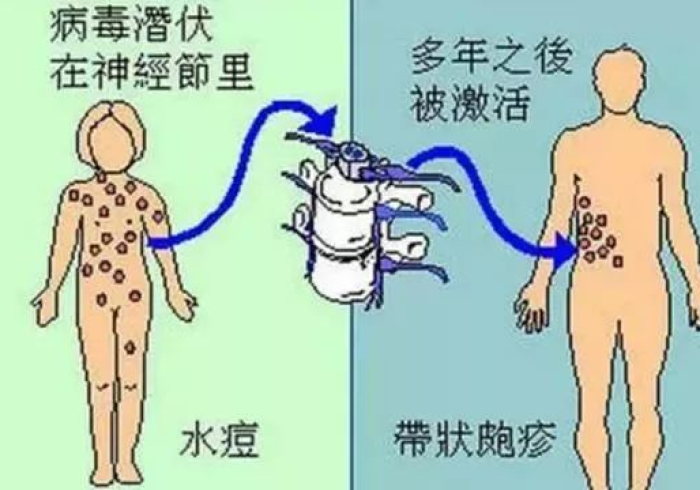 猪流感是rna病毒吗(猪流感是rna病毒吗会传染吗) 猪流感是rna病毒吗(猪流感是rna病毒吗会传染吗)